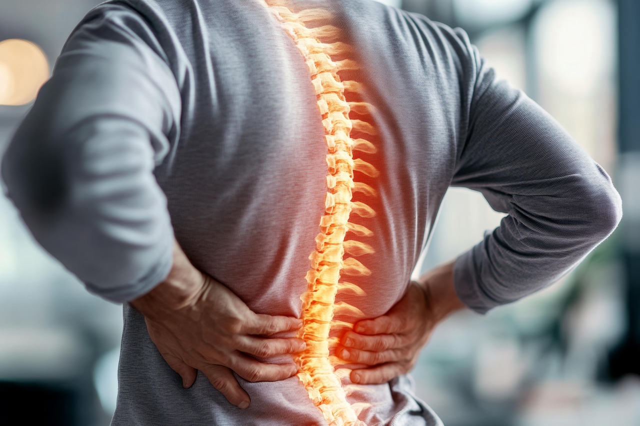 herniated-disc-8941861_1280